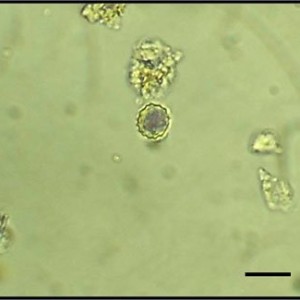 Phytoliths: What They Are and What They Tell Us
